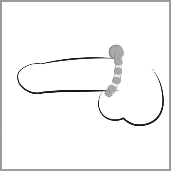NMC Maximum Metal Ring – Bild 6