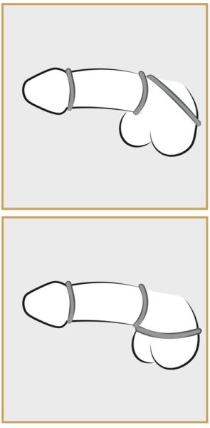 You2Toys Metallic Silicone Cock Ring Set – Bild 8