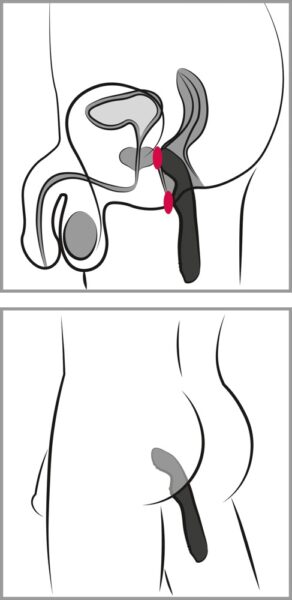 Rebel P-Spot Vibrator – Bild 8