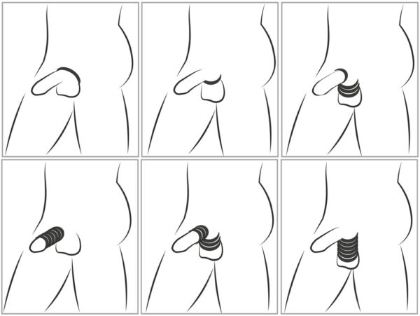 You2Toys Cock & Ball Stretching Kit – Bild 6