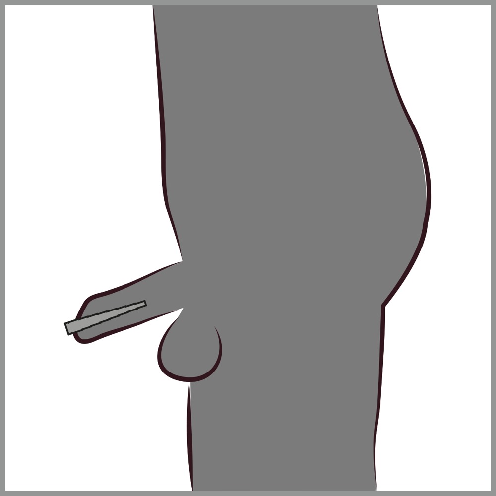 fetish Collection Stepped Dilator – Bild 7