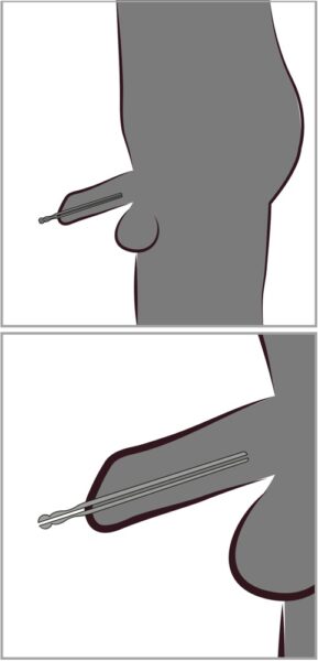 fetish Collection Hollow Dilator – Bild 8