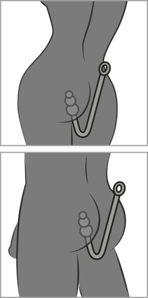 fetish Collection Bondage Hook – Bild 7